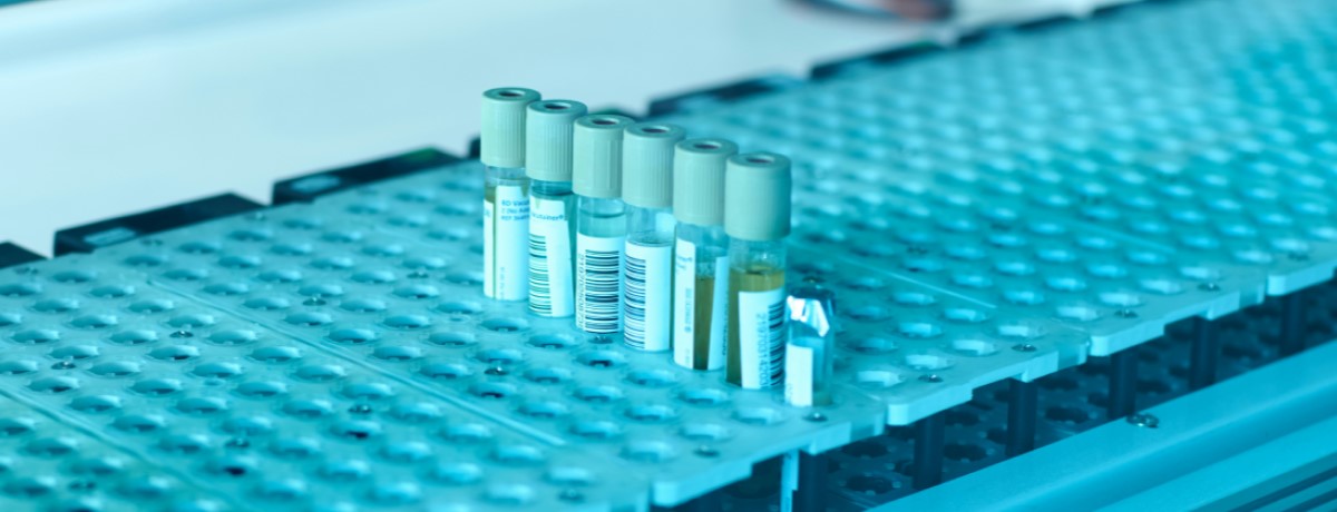 lab samples