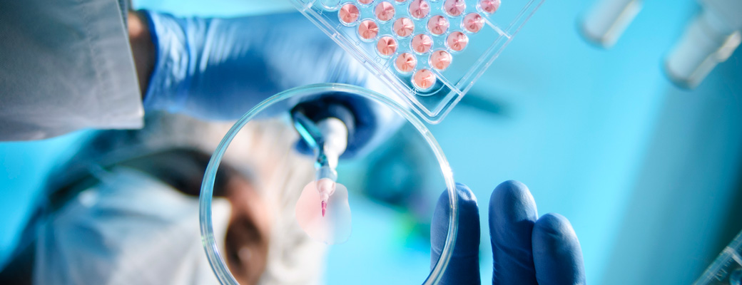 lab experiment